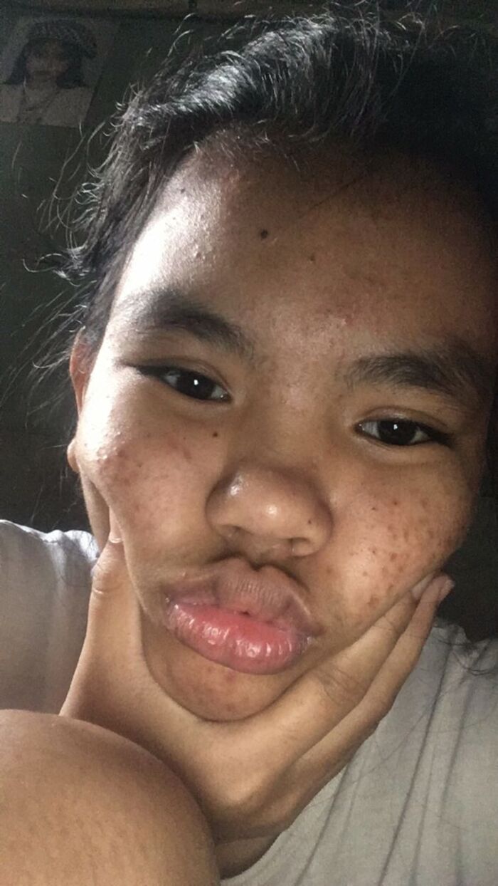 ảnh gái xấu bựa