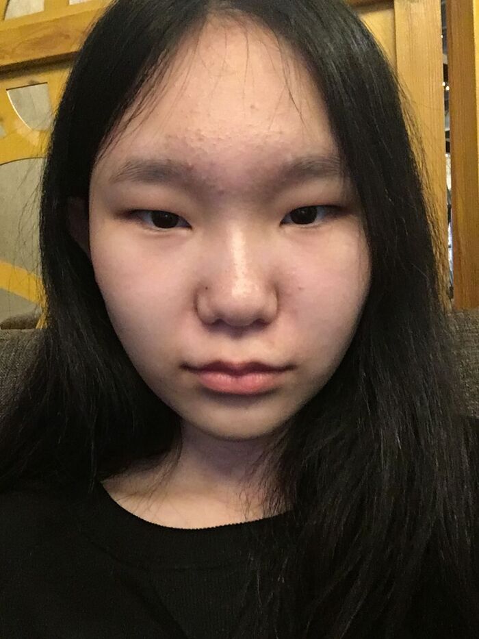hình ảnh gái xấu no make up
