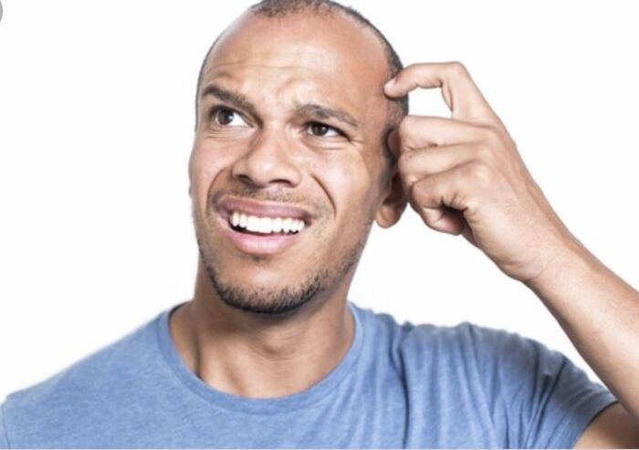 ảnh meme gãi đầu chế hài